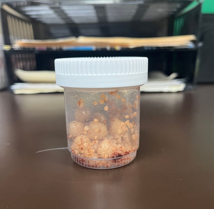 Common Symptoms of Bladder Stones in Pets and How to Treat Them